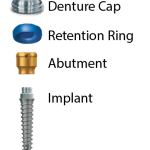 Dental Implant Sections for Dentures