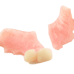 denture broken repair smiles centre fix swindon