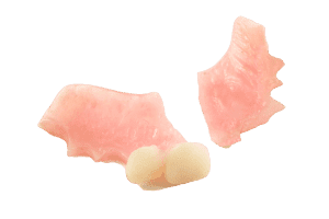 denture broken repair smiles centre fix swindon