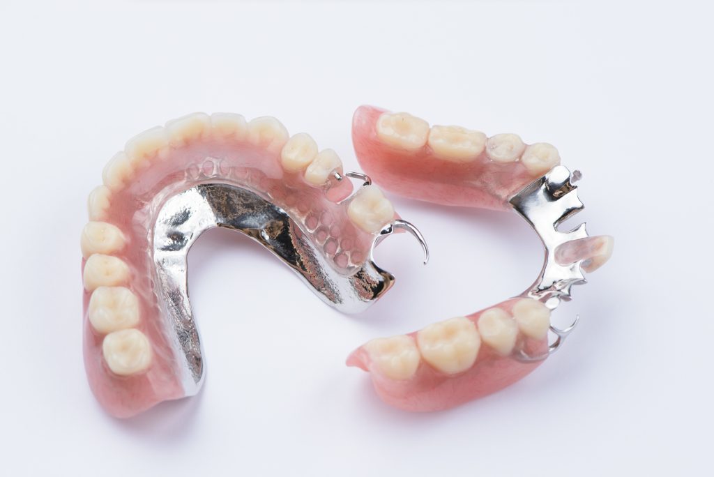 Metal Dentures